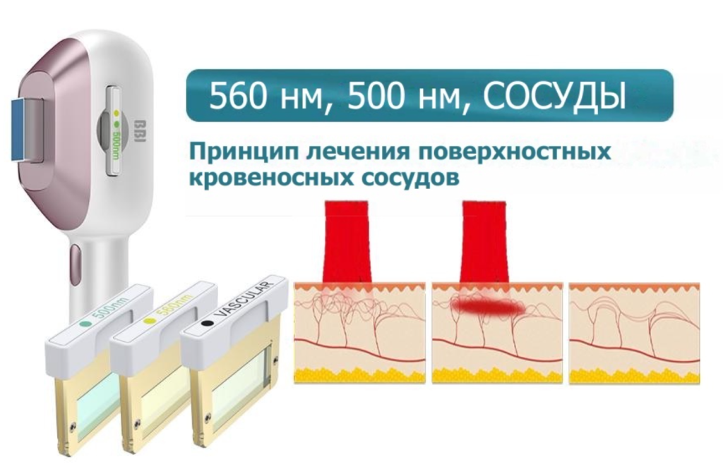 snimok-ekrana-2023-07-31-v-17.42.44.png snimok-ekrana-2023-07-31-v-17.42.44.png